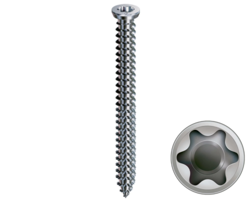 Wkręt kotwa ramowa okienna stożkowa.png